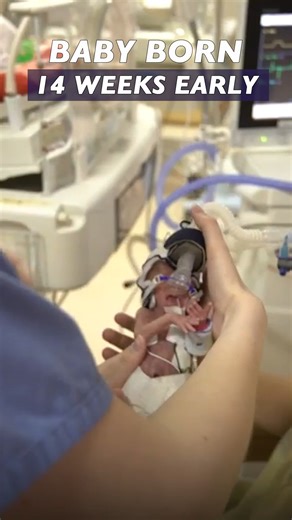 Reality of a premature baby 😳 | Four Nine