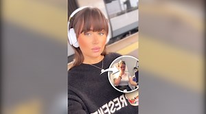 Woman’s Journey of Hairline Lowering Transformation