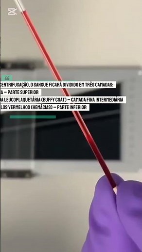 Exame de Hematócrito
