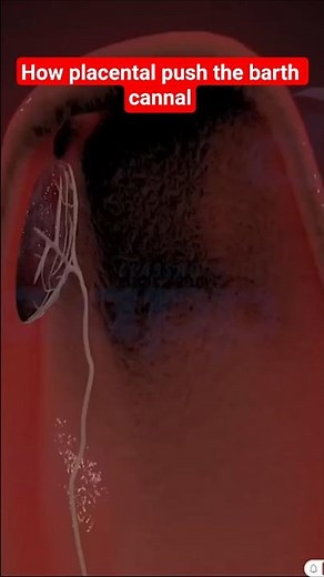 How the Placenta Is Delivered After Birth | 3D Animation Explained 👶🩸 #Shorts