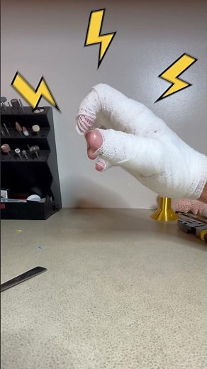 Pain Control With 3D Printing