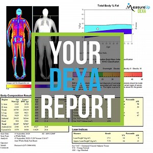 Where to Find Your DEXA Scan Reports | MeasureUp™