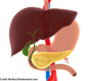 Cholecystitis NCLEX Questions