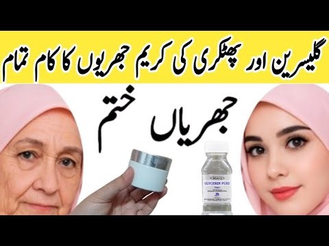 Get Rid of WRINKLES in 7 Day Completely with Anti Wrinkle Cream from Under Eye or Face ,maham