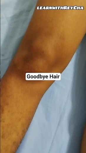 Leg Waxing Before & After - Look At These Results! 😍