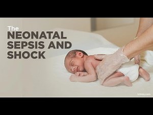 Presentation Signs and symptoms of Neonatal sepsis