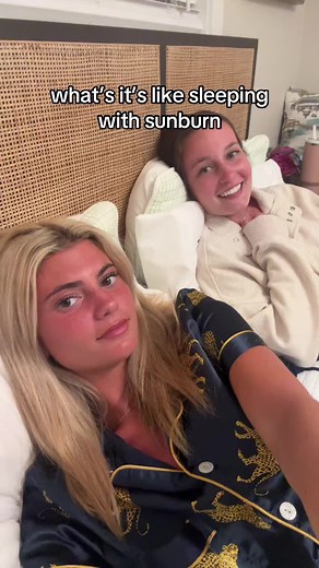 Experiencing the Worst Sunburns in Florida