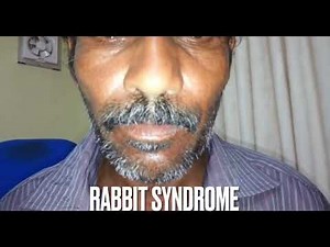 RABBIT SYNDROME 🐇 involves a rhythmic, vertical only motion of the mouth/lips #neurology #medical