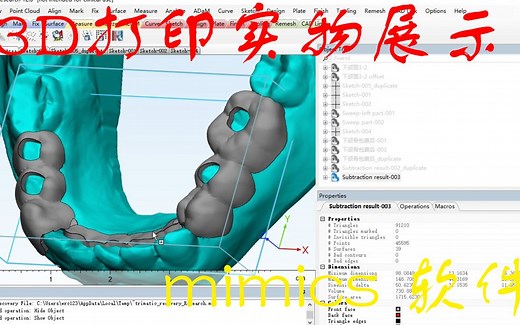 mimics 3D打印口腔实物展示