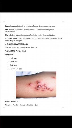 Poxvirus small Poxvirus (Variola Virus) Explain in 30 Seconds
