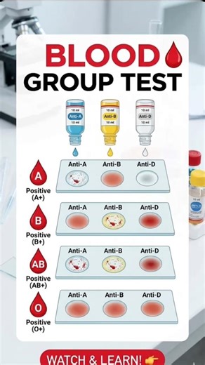 A+, B+, AB+, O+ Blood Group Test | Slide Method | Medical Lab Practical