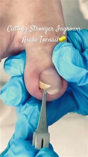 The Ultimate Guide to Fix Toenail Regrowth!