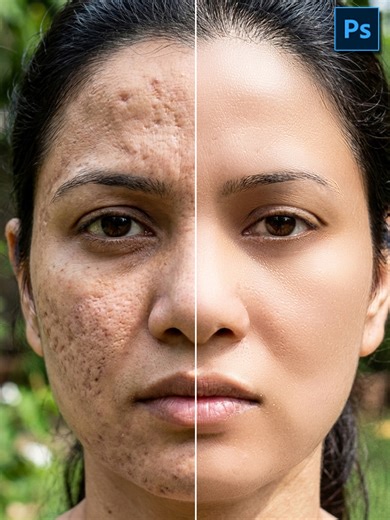 How to Skin Retouch Using Frequency Separation in Adobe Photoshop Like a Pro | Advanced Portrait Retouching Tutorial #AdobePhotoshop #Photoshop2026 #FrequencySeparation #SkinRetouching #PortraitRetouching #PhotoshopTutorial #BeautyRetouch #PhotoEditing #ProfessionalRetouching #PhotoshopTips #HighEndRetouch #GraphicDesign #DigitalArt #RetouchingTechnique #CreativeEditing | Graphics Solution Tricks