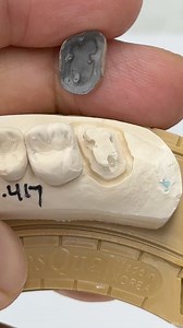 The most great tooth retentions! Dr,Julie Tennant Conlin in Illinois | Luke Kahng