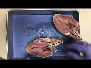 Heart Dissection