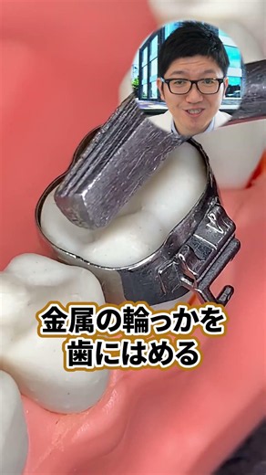 The dentist explains the dental instruments used in orthodontic treatment! [Yoshioka Dental Clinic]