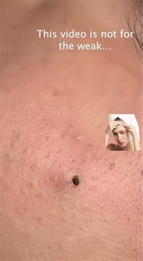 The most disgusting thing you've seen today