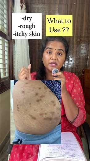 dark marks on bums and buttocks - products to reduce bums dark marks and pigmentation , dry skin