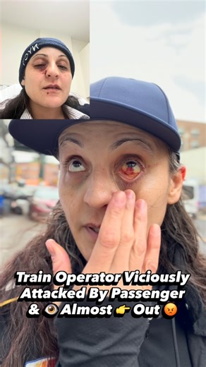 A train operator was viciously attacked at the World Trade Center station — punched, kicked, and targeted while alone and defenseless. No provocation. No protection. No refuge. Train Operator Castro said it clearly: if there were police present at the terminal, this likely never would have happened. And if there was a break room, a women’s locker room, or any safe space to wait between intervals, she wouldn’t have been left exposed. Coworkers want to help — but fear stops them. When a train oper