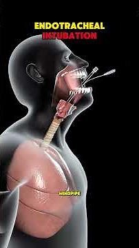 Endotracheal Intubation Explained in 30 Seconds 🫁 | Health Education #shorts