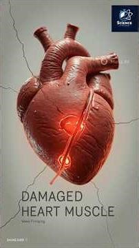 हार्ट अटैक कैसे होता है? | Step by Step 3D Animation | Heart Attack Explained in Hindi