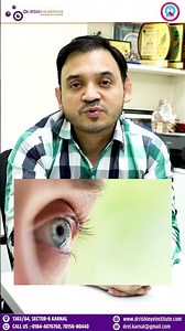 Eye Allergies | Causes, Symptoms & Treatment | By Dr. Rishiraj Singh |