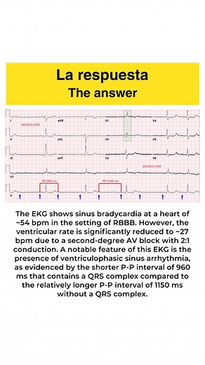 Looking for amazing and unique ECGs?Need ECG Qbanks?Want cardiovascular videos?Preparing for cardiology boards?Searching for an App to learn ECG?Interested in an ECG simulator?Look no further—EKGDX has it all! | EKGDX