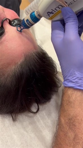 Pixel laser is all about improving texture, tone, and skin quality over time. By stimulating collagen and resurfacing the skin, Pixel helps address concerns like acne scarring, fine lines, and uneven texture—without relying on quick fixes. Results build gradually with a thoughtful treatment plan and proper aftercare. If you’re ready to get started, book 📞 a consultation to see if Pixel is the right fit for your skin! - Located in 🍊Orange, CA 📲 (714) 538-6072 https://skineticsinc.com Follow 👉