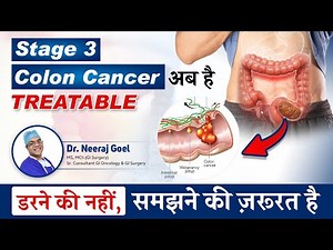 Stage 3 Colon Cancer- How to treat & what to expect? बड़ी आंत का कैंसर- Stage 3