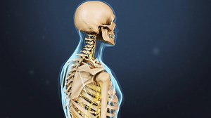 Diagnosing Cervical Osteoarthritis