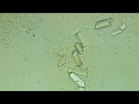 Cristales en orina