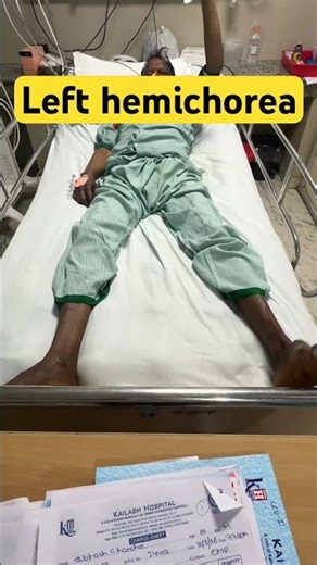 Hemichorea: When the Brain Causes Dancing Movements #hemichorea #movementdisorders #drsorabhgupta