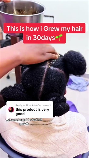 Effective Hair Growth Oils You Need to Try