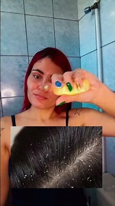 WAYS TO USE SULFUR SOAP 🧼💛