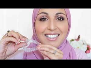 MON APPAREIL DENTAIRE 1 MOIS APRÈS