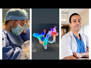 An ablation not to be missed!