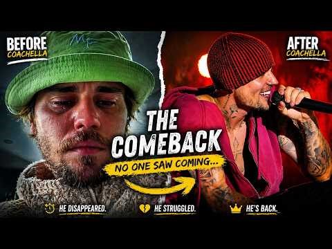 What Happened to Justin Bieber? (Before & After Coachella)
