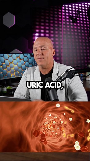 Gout is a common and complex form of arthritis that can affect anyone. It’s characterized by sudden, severe attacks of pain, swelling, redness, and tenderness in one or more joints, most often in the big toe. Gout occurs when urate crystals accumulate in your joint, causing the inflammation and intense pain of a gout attack. Urate crystals can form when you have high levels of uric acid in your blood. Your body produces uric acid when it breaks down purines which are usually found in certain foo