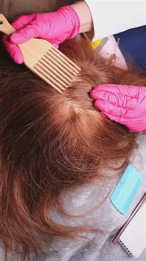 ASMR Fast scalp scratching with wooden comb