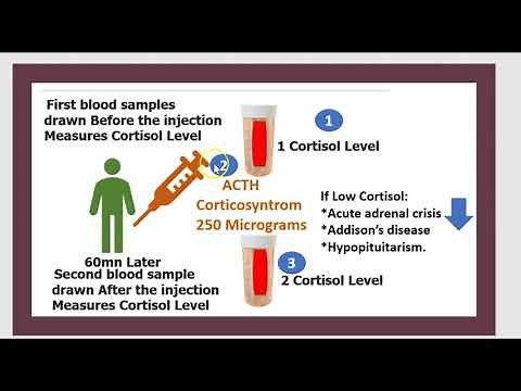 2-Minute: Test de Stimulation de L'ACTH Adrénocorticotrope Cosyntropin/ Hypophyse Surrénale Addison