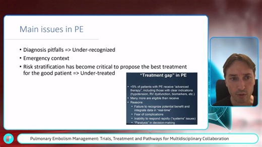 Prof Gilles Lemesle addresses the real-world challenges of diagnosing pulmonary embolism (PE) in the emergency department and shows how rapid, coordinated teamwork can improve patient care. Watch the full video on ‘Multidisciplinary Collaboration and Patient Pathways’ here 👉 https://ow.ly/IFKe50XlKnK Highlighting the role of Pulmonary Embolism Response Teams (PERT), he discusses the importance of accurate risk stratification, the barriers to timely treatment, and how multidisciplinary systems c