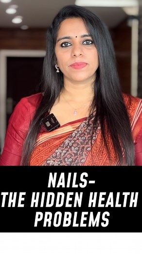 Lekha Dharsak on Instagram: "Discover the secrets your nails reveal about your health! From brittle nails to nail discoloration, learn what your nails are trying to tell you. Watch now and take control of your health! #nailhealth #healthsigns #wellnesstips #nailcare #healthandbeauty #nailgoals #healthyliving #selfcare"
