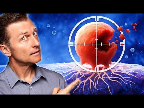How to Never Get Cancer (30 Scientifically Proven Tips)