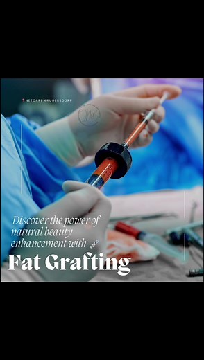 𝑳𝒊𝒑𝒐𝒎𝒐𝒅𝒆𝒍𝒍𝒊𝒏𝒈 💉 Fat transfer, also known as fat graft, lipomodelling, or fat injections, is a surgical process in which a person’s own fat is transferred from one area of the body to another area where it is needed more, 𝒍𝒊𝒌𝒆 𝒚𝒐𝒖𝒓 𝑩𝒓𝒆𝒂𝒔𝒕𝒔! 🍒 Breast fat transfer is at the very cutting edge of regenerative medicine and processed fat and offers many benefits such as: 🍒Provides Natural Body Sculpting for a bespoke breast augmentation made for you! 🍒fat transfer can be