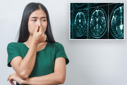 P.U. IQ! Sniffing your own farts could boost brain power, fend off Alzheimer’s: new study