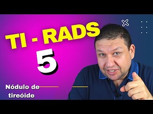 NÓDULO DE TIREÓIDE TI-RADS 5. Fez o ultrasson de tireóide e descobriu um nódulo ti-rads 5.