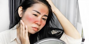 In lupus breakthrough, researchers say they may have found what causes the autoimmune disease