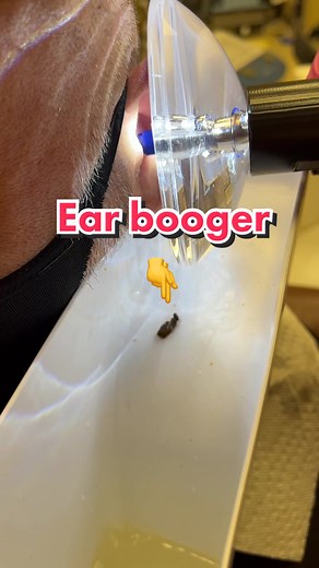 Satisfying Ear Wax Removal with Earigator
