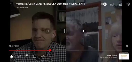 Ivermectin kills stage 4 colon/liver cancer.CEA 1500 to 4 with 2 weeks of ivermectin This guy started taking Ivermectin for Covid and it cured his stage 4 cancer that metastasized into over 20 liver tumors. His CEA went from 1500 to 4 in one 2 week treatment.