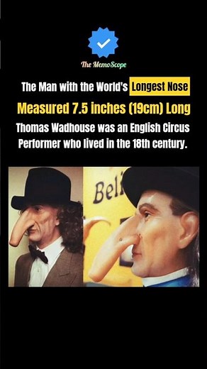 The Man with the World's Longest Nose | 👃 Measured 7.5 inches (19cm) Long